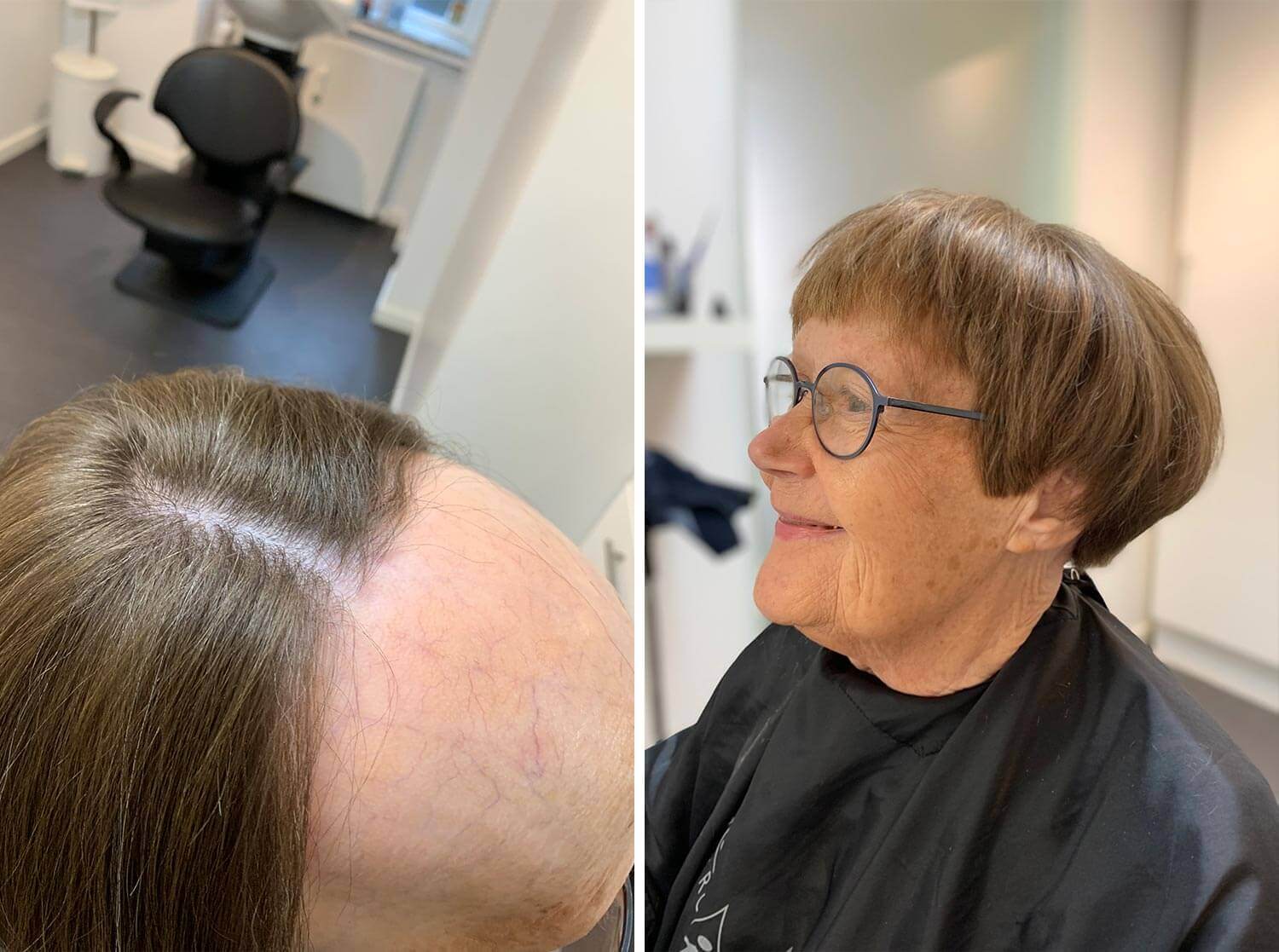 Toftild Hår For Livet kan hjælpe dig med hårtab i forbindelse med alopecia. Du kan booke din konsultation gratis