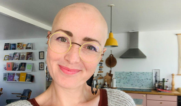 Aja's Alopecia Rejse: Mine Tre Livsændrende Faser med Hårtab