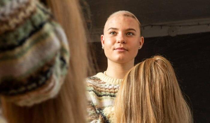 Sådan tacklede Nanna og hendes familie alopecia