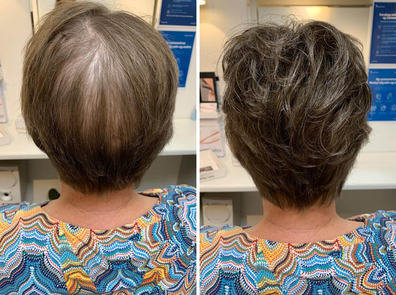 Før- og efter billede med en mørk hairtopper 